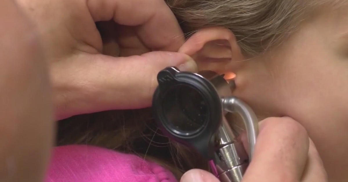 What causes ear infections? CBS Minnesota