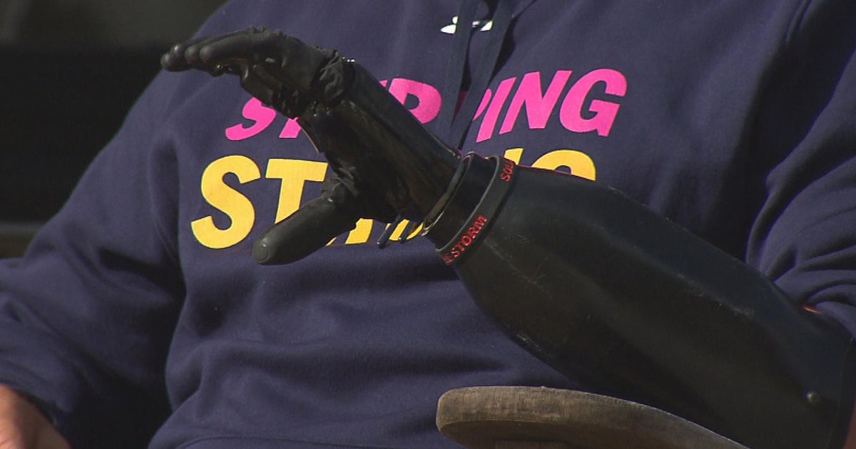 West Bridgewater man receives firstofitskind surgery thanks to