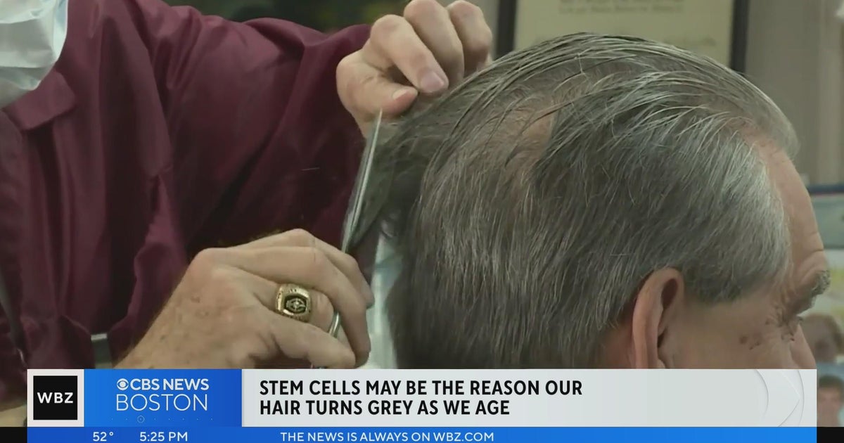 New study sheds light on what makes hair turn grey - CBS Boston