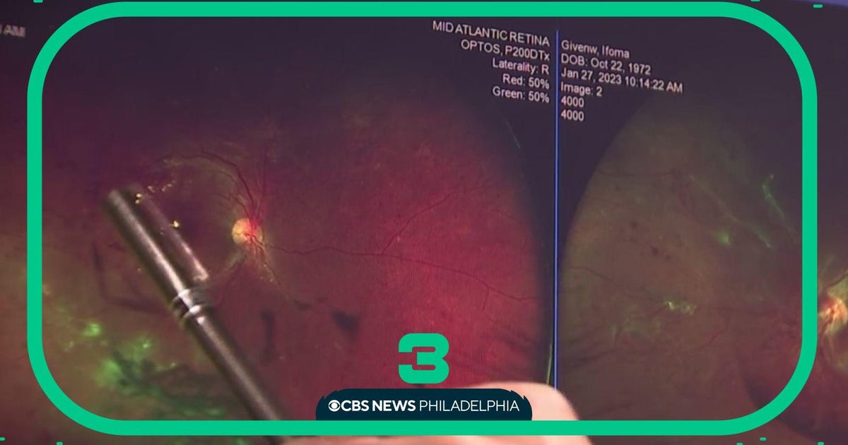 Free Screening Event In Philly Aim To Save Vision For People With