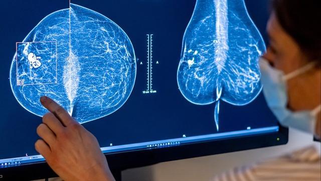 cbsn-fusion-why-experts-say-mammograms-should-start-at-age-40-thumbnail-1954991-640x360.jpg 