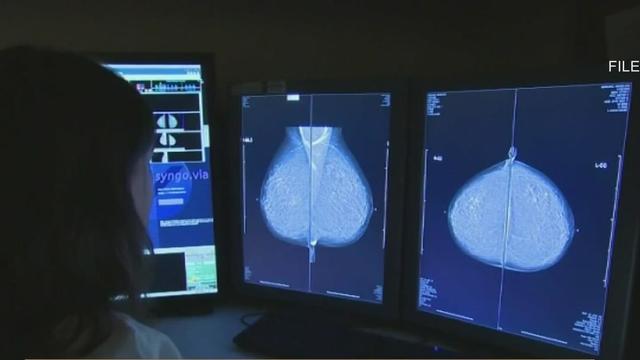 breast-cancer-screening.jpg 