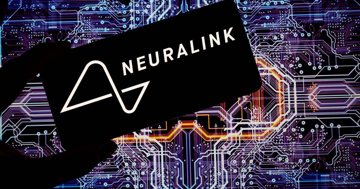 Musk startup Neuralink says it's been cleared to test brain implants in humans