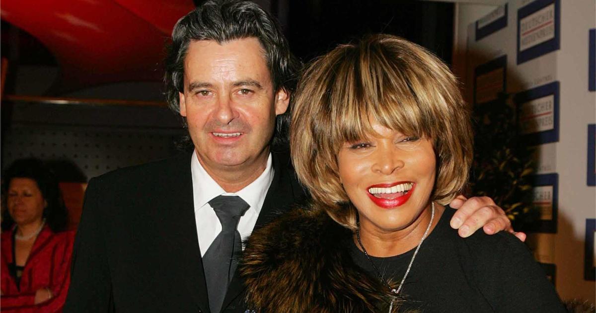 Tina Turner's husband donated a kidney to her, years before she died
