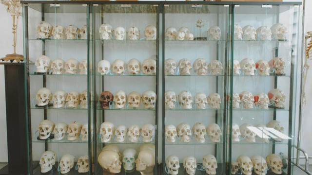 Human bone collection 