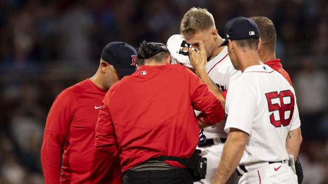 Facial injury to Tanner Houck puts damper on Red Sox' offensive