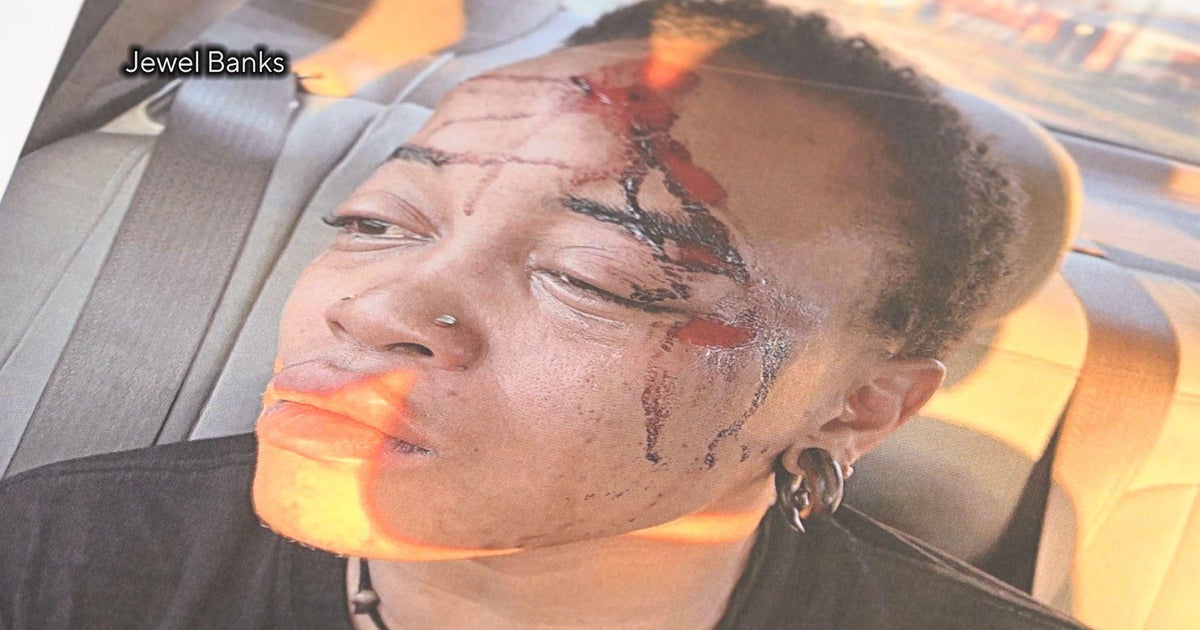 Warren Police Department facing another 50 million lawsuit due to alleged police brutality Warren Police Department facing another 50 million lawsuit due to alleged police brutality