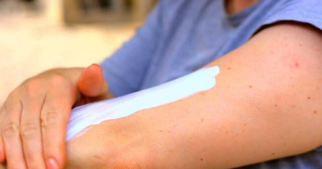 Anti-Sunscreen and Tanning Tips Trending on Social Media, Experts Debunk Popular Myths