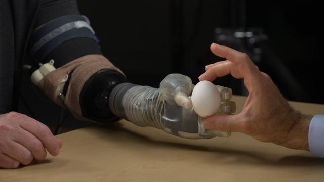 prosthetic-video-2130602-640x360.jpg 