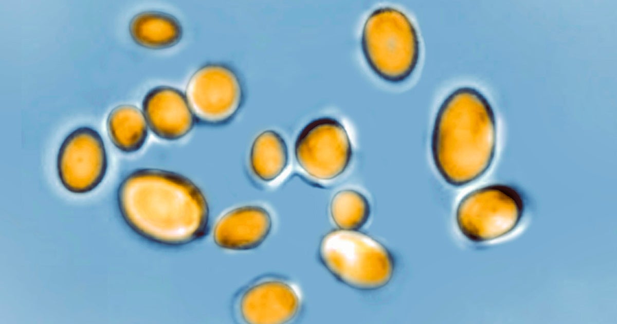Sudden explosion of dangerous fungus Candida auris may be because of climate change, scientists say Sudden explosion of dangerous fungus Candida auris may be because of climate change, scientists say