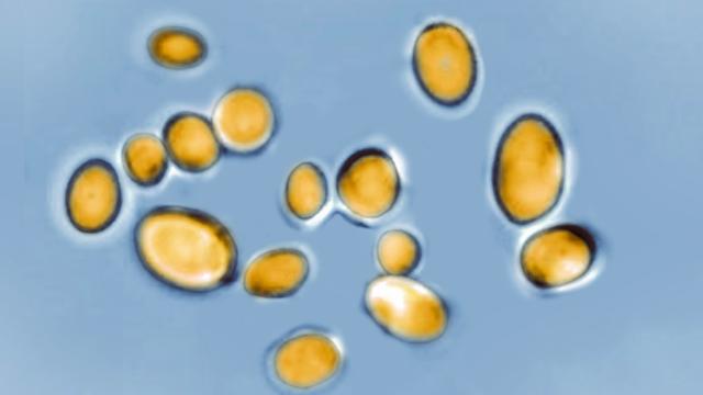 Candida auris, seen with an optical microscope, is a yeast responsible for many infections that's resistant to most antifungal drugs and has caused several deaths worldwide. 