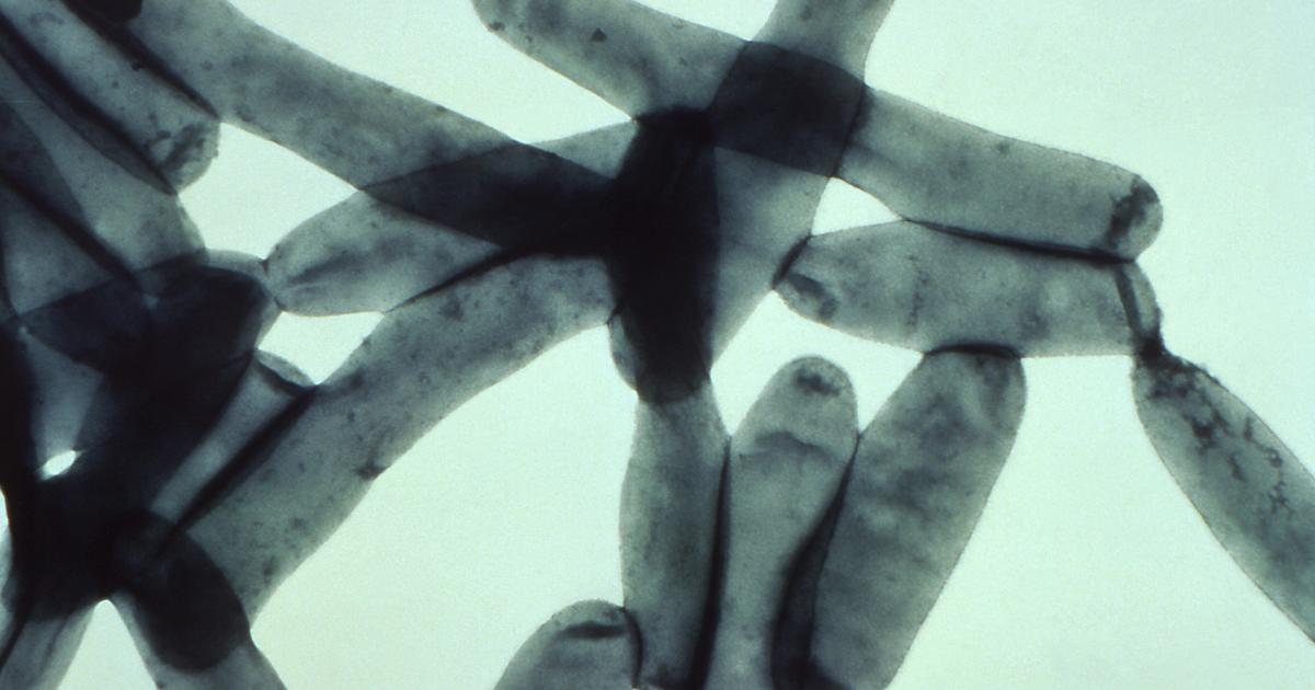 Possible Legionnaires cluster explored in Passaic County