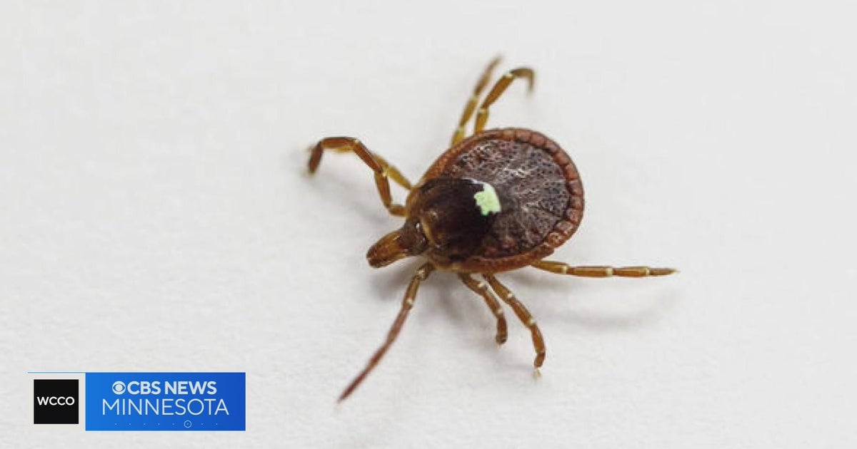 Talking Points Lone Star tick carries potentiallyfatal meat allergy