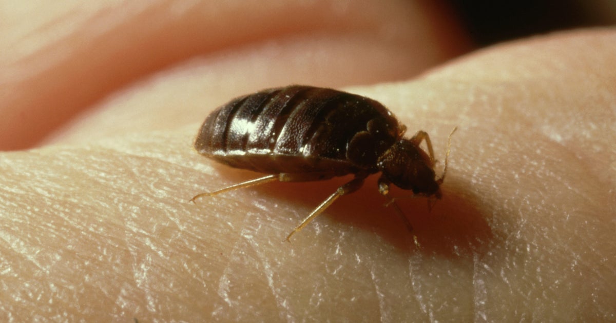 Paris is having a bedbug outbreak Heres expert advice on how to protect yourself while traveling  CBS News Paris is having a bedbug outbreak Heres expert advice on how to protect yourself while traveling  CBS News
