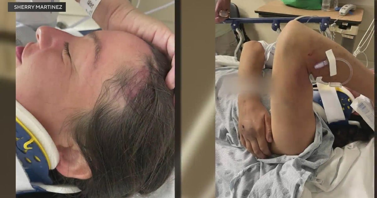 Sacramento biking advocate speaks from hospital bed after driver intentionally ran her over