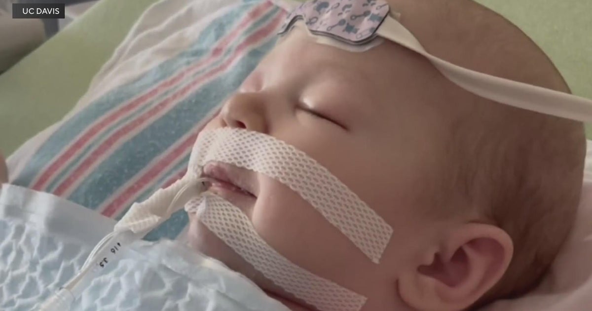 Baby&rsquo;s heart defect caught after being admitted for RSV