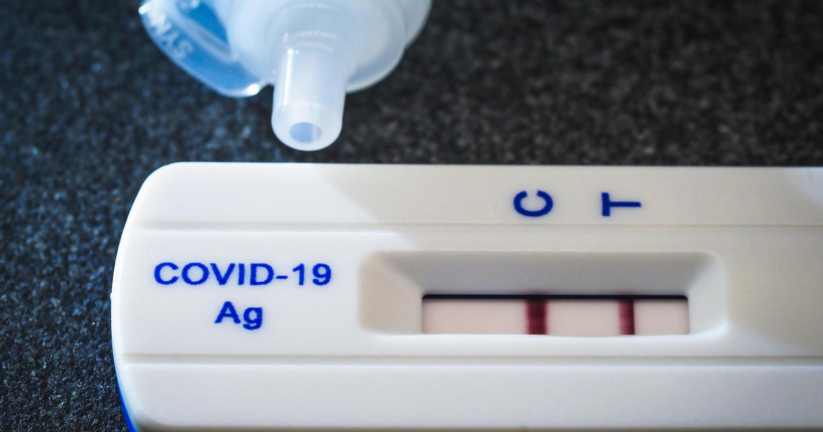 Need COVID-19 tests? What to know as cases rise
