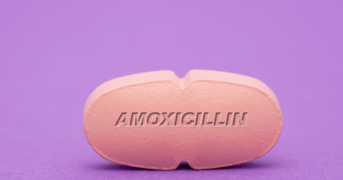 Shortage of common antibiotic used to treat kids’ infections frustrates parents Shortage of common antibiotic used to treat kids’ infections frustrates parents