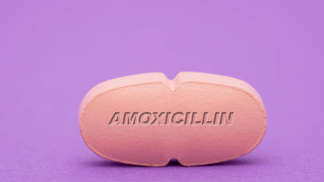 Amoxicillin pill, conceptual image 
