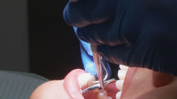 free-dental-care-5vo-transfer-frame-202.jpg 
