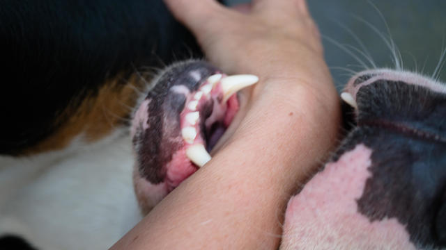 Dog biting the arm of a person 