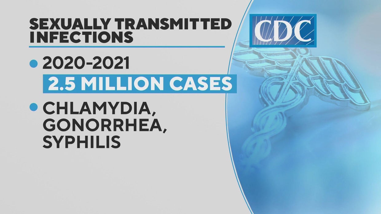 CDC proposes new type of morning after pill to combat sexually ...