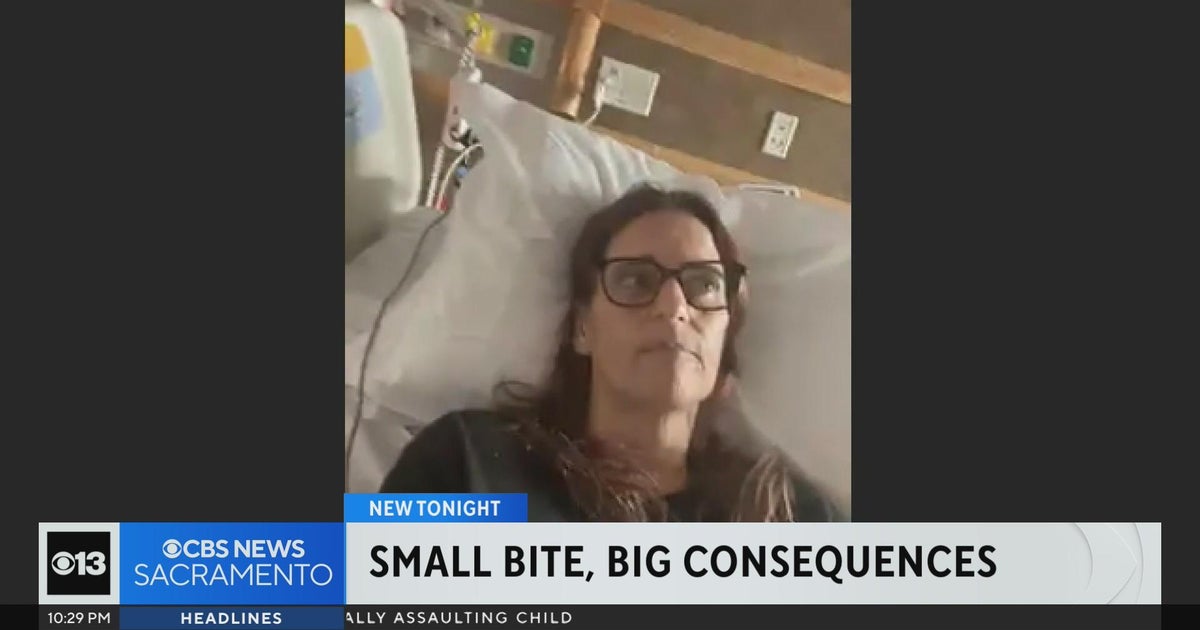 Sacramento County woman contracts West Nile from mosquito bite, left unable to walk