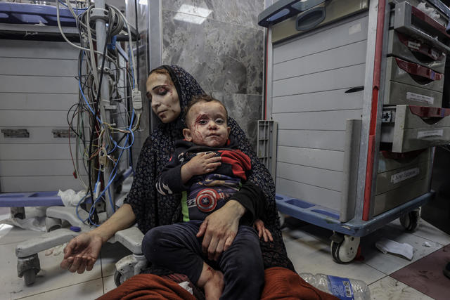 Wounded people after attack on Gaza Al-Ahli Baptist Hospital 