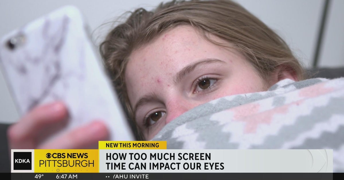 How too much screen time can impact the eyes - CBS Pittsburgh
