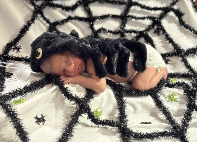 baby-halloween-credit-childrens-minnesota-2.jpg 