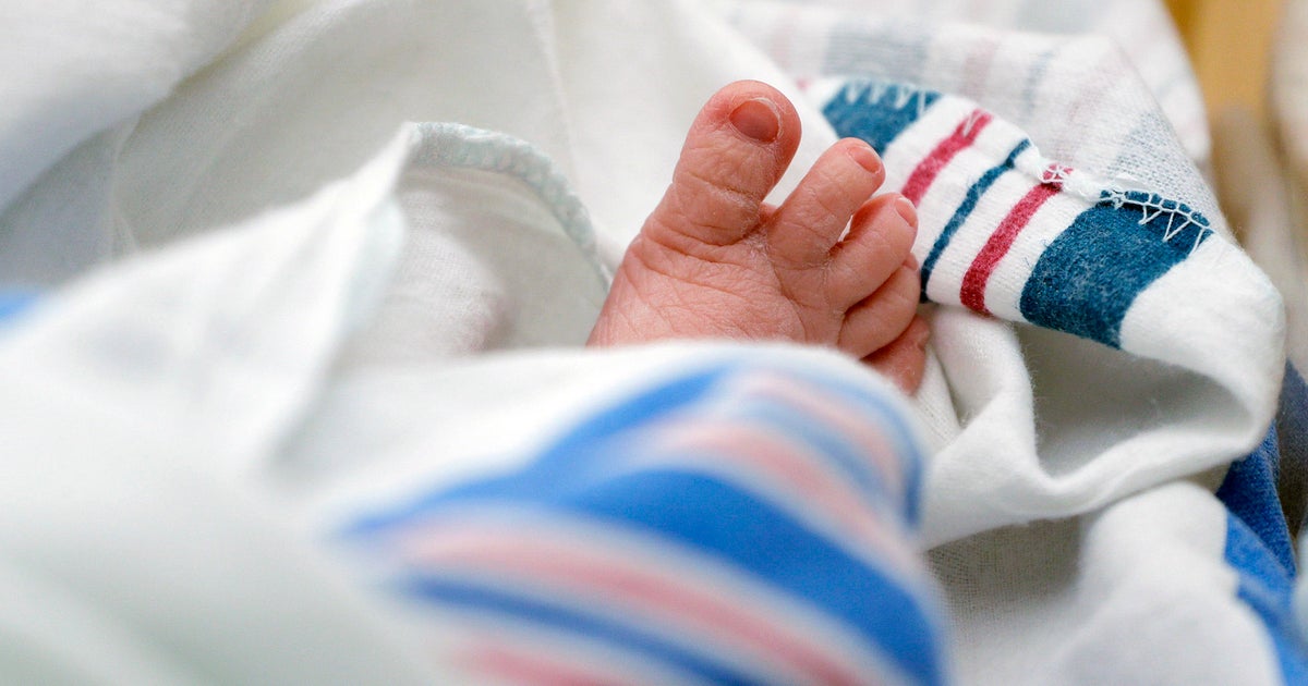 U.S. infant mortality rate rises for first time in 20 years; U.S. infant mortality rate rises for first time in 20 years;
