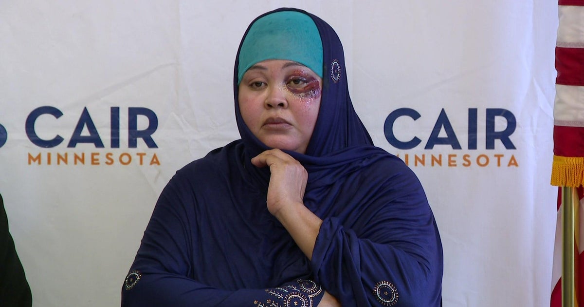 Police investigating attack of Muslim woman at Minneapolis gas station