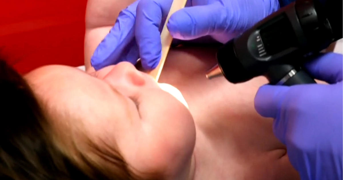 Demand for RSV shot is so high, CDC is recommending it only for the most vulnerable
