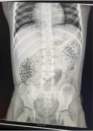 xray-waterbeads.png