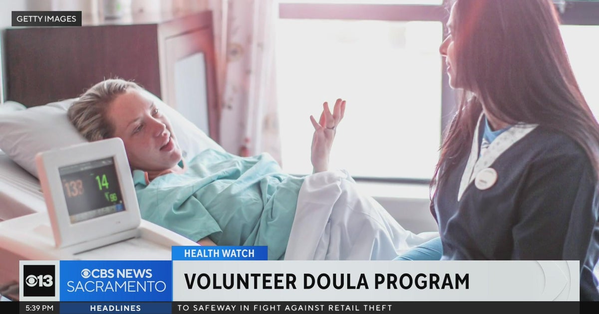 UC Davis Medical Center asking for more volunteer doulas to help with childbirth