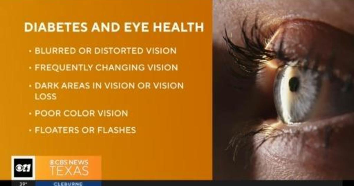 why-you-need-a-routine-eye-exam-malandracia