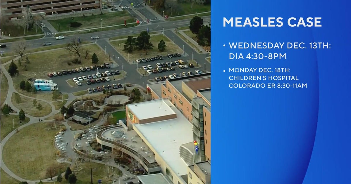 Measles case being treated in Colorado for the first time in 4 years