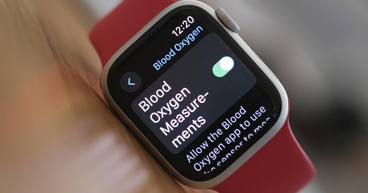 Апелативният съд възстановява забраната за продажба на модели на Apple Watch с монитор за кислород в кръвта