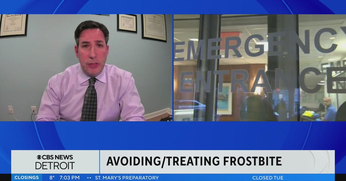 How to avoid and treat frostbite CBS Detroit