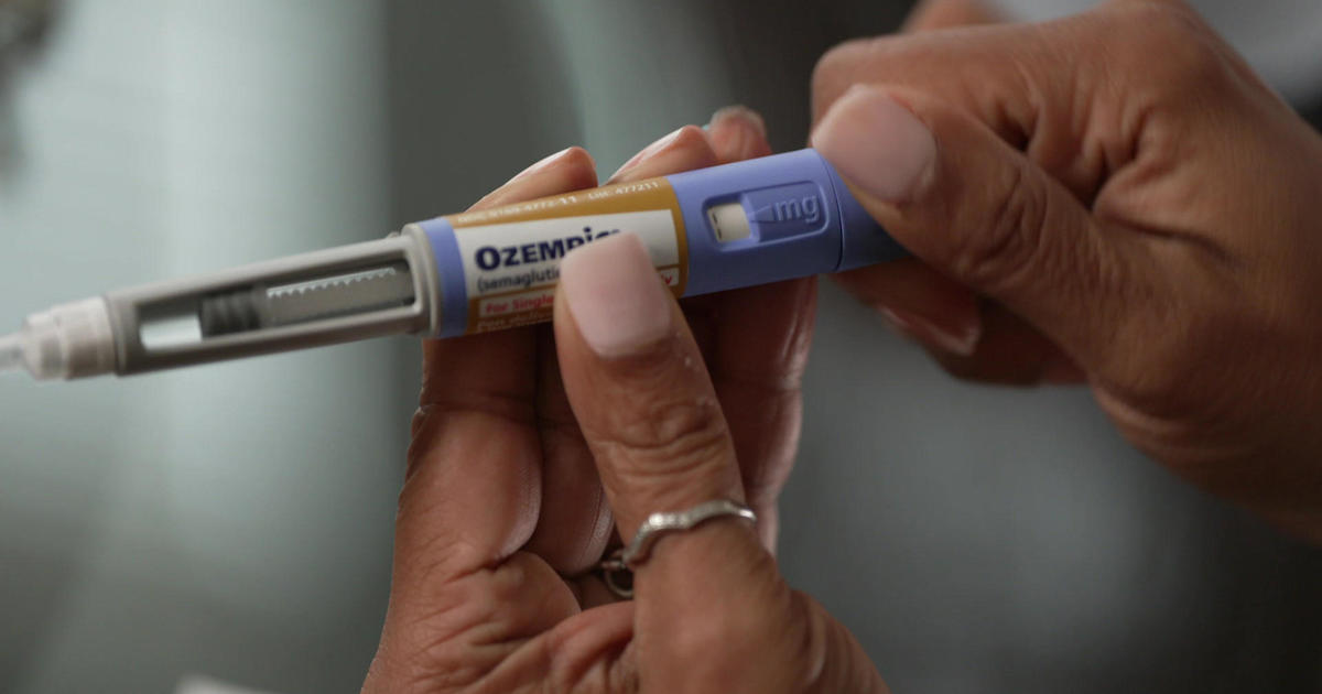 How Ozempic, other weight-loss drugs are “changing medicine”
