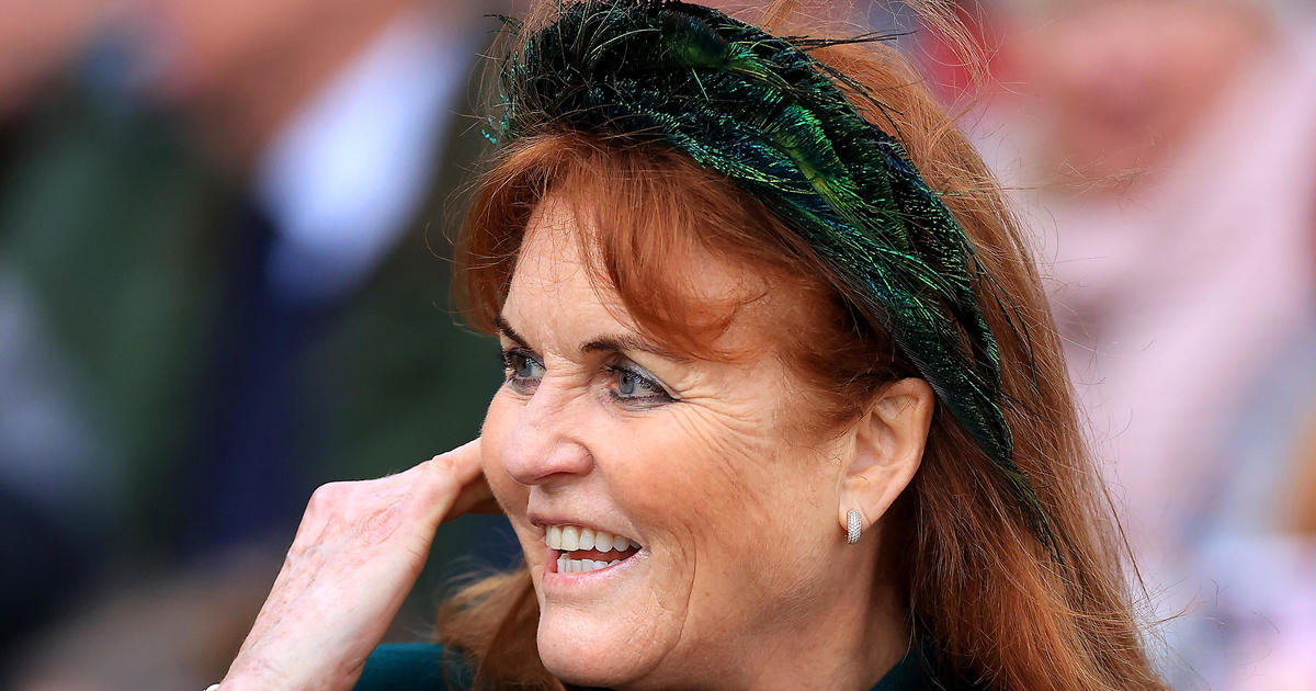 Sarah Ferguson, Duchess of York, was diagnosed with malignant melanoma after battling breast cancer