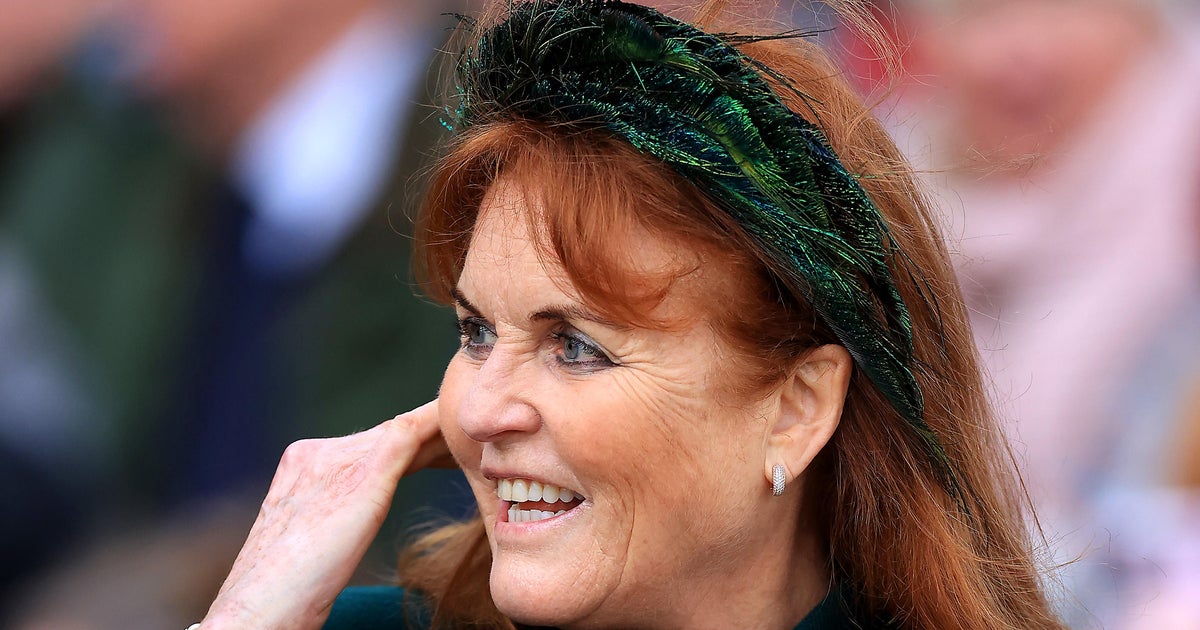 Sarah Ferguson Duchess of York diagnosed with malignant melanoma after battling breast cancer  CBS News Sarah Ferguson Duchess of York diagnosed with malignant melanoma after battling breast cancer  CBS News