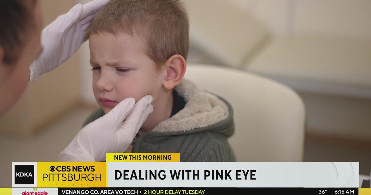 Pink Eye, Sarasota, Bradenton, Florida