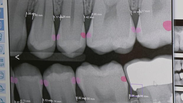 ai-software-of-teeth.jpg 