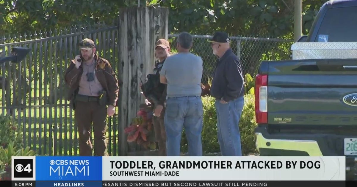 Toddler, grandma attacked by dog - CBS Miami