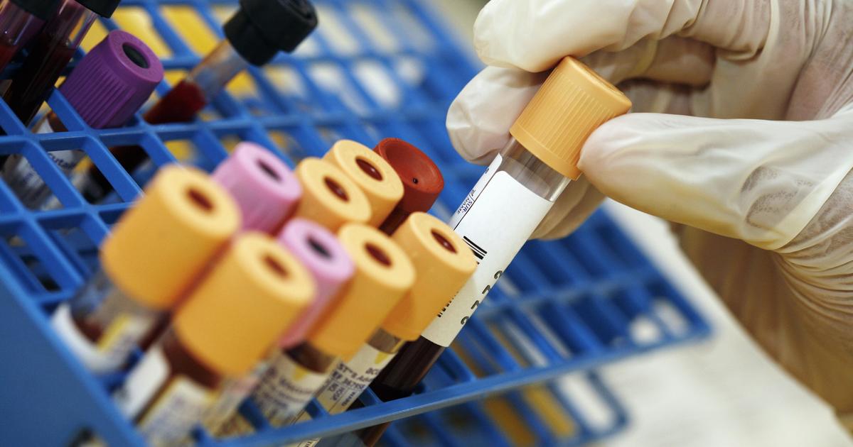 What do your blood test results mean? Here’s an expert’s advice on how to interpret them.