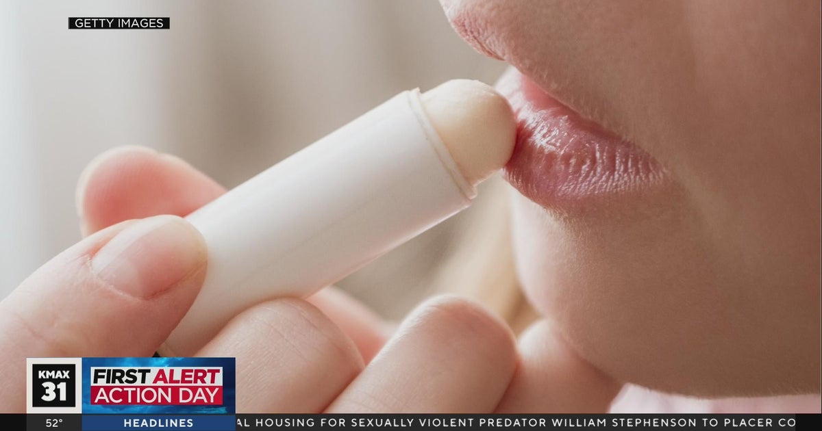 The Answer: Chapped lips?