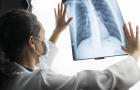 Doctor looks at X-ray image of lungs 