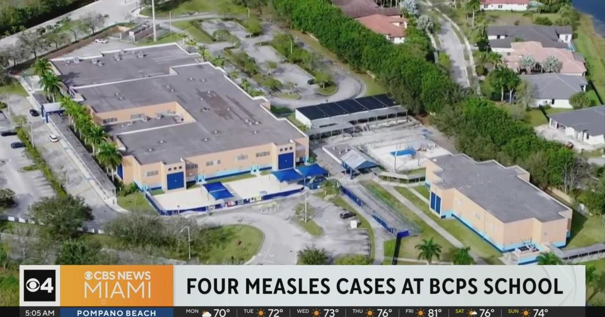 4 scenarios of measles at Weson elementary college
