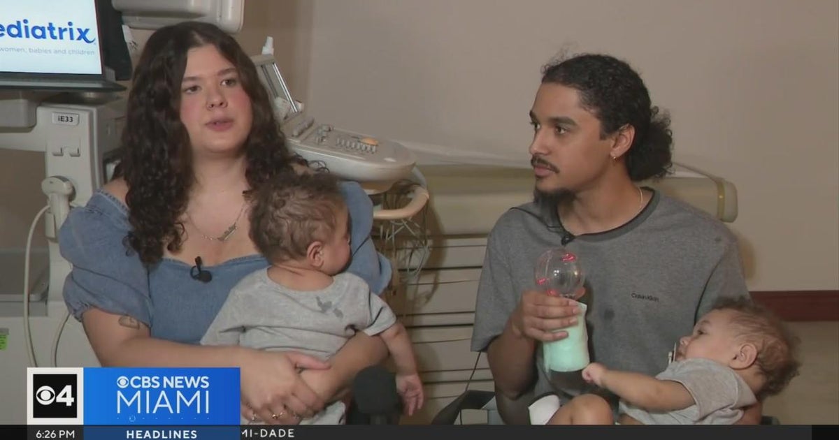 Twins babies with rare heart defects fight the odds - CBS Miami